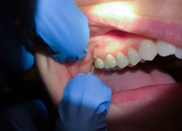 Best Walk-In Emergency Dentist in Latham, NY